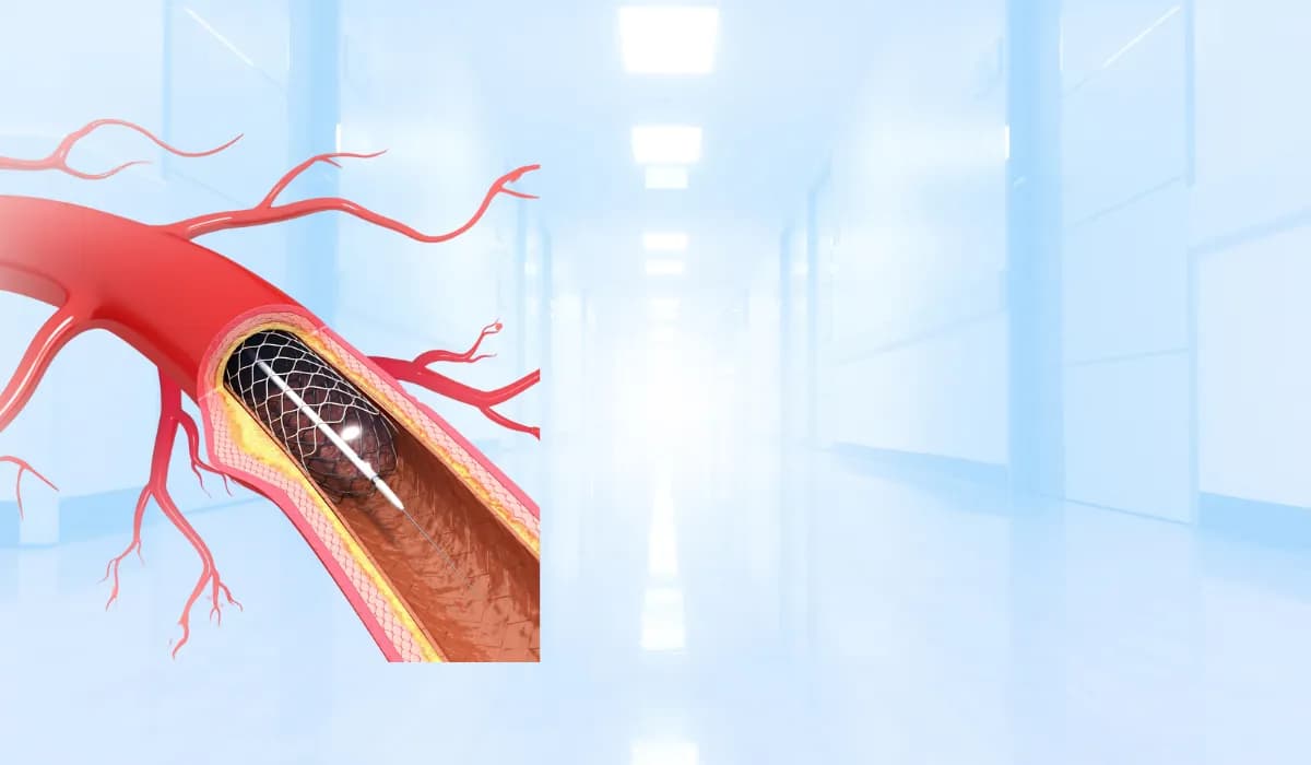 قسطرة القلب وتركيب الدعامات