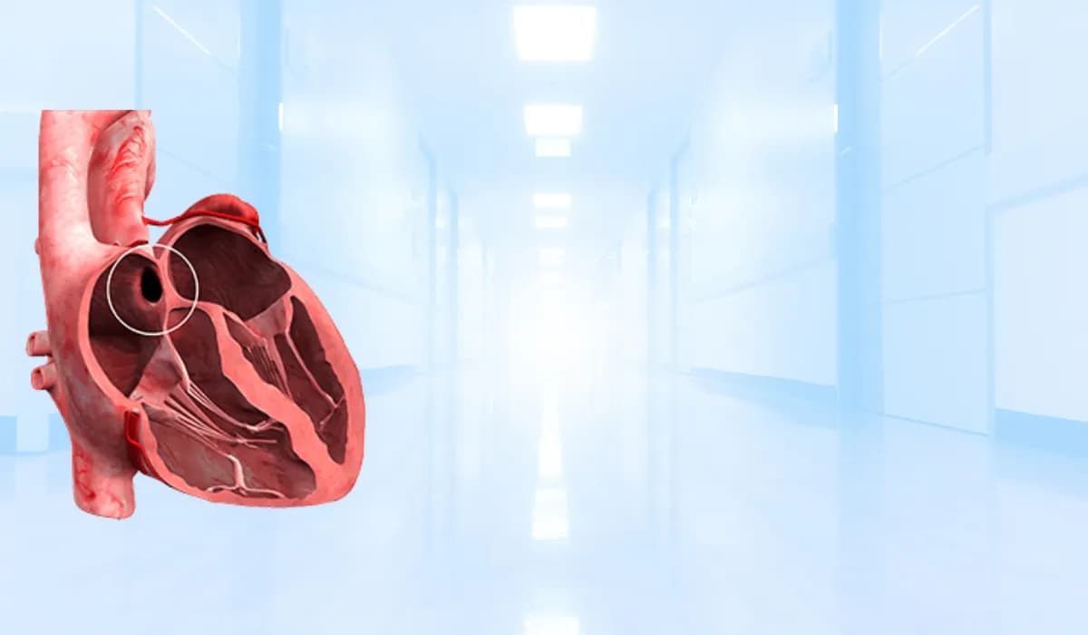 إغلاق ثقب الحاجز الأذيني