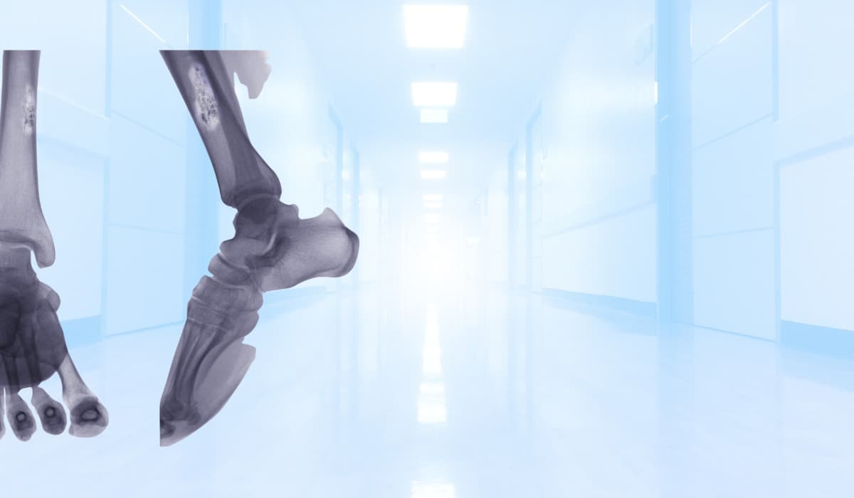 Bone Cancer Treatment