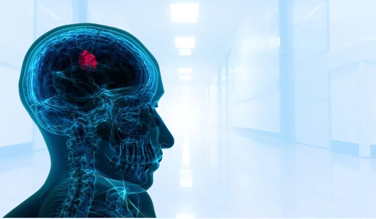 جراحة أورام الدماغ