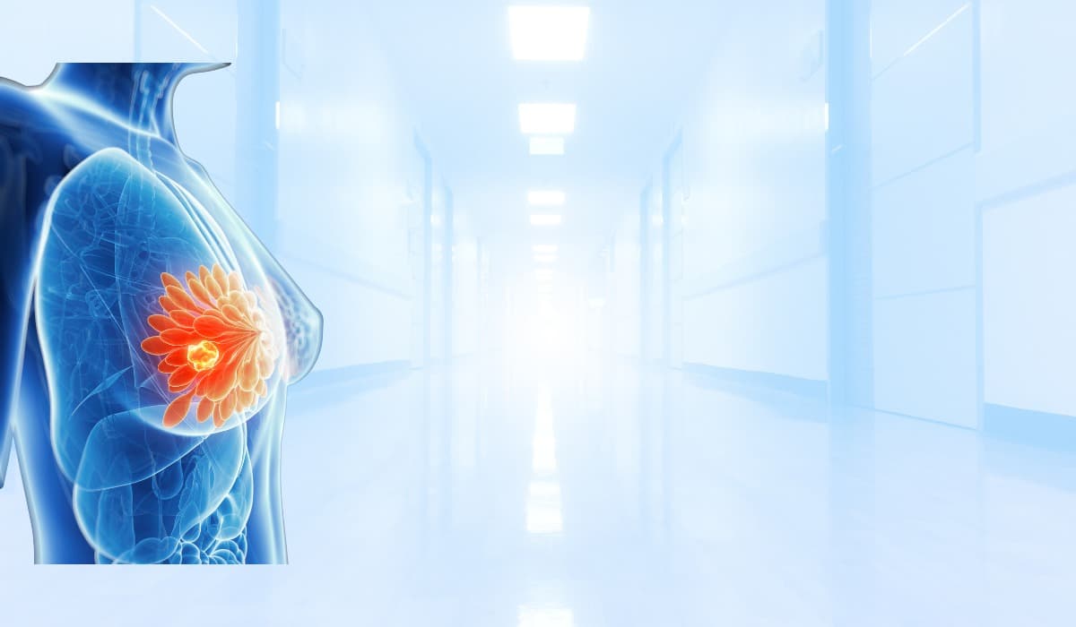 Breast Cancer Treatment