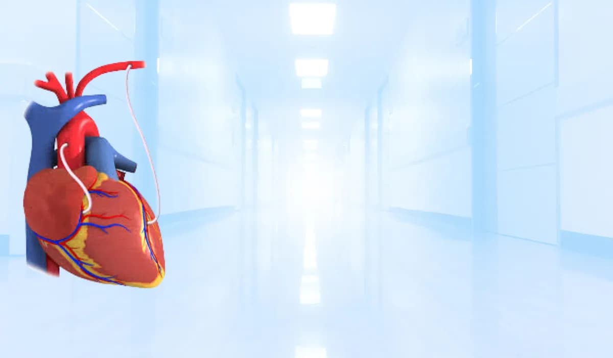 جراحة تحويل مسار الشرايين التاجية