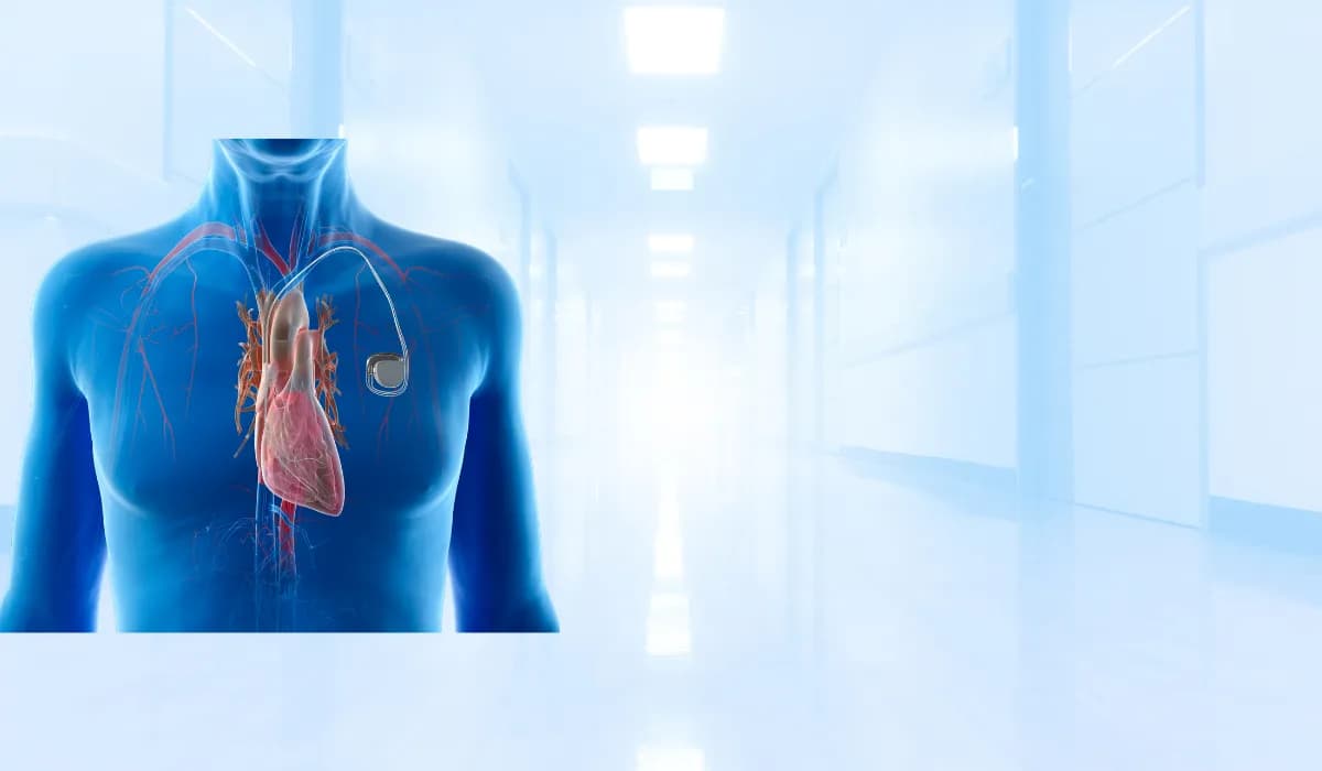 زراعة منظم ضربات القلب الدائم