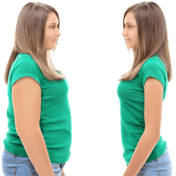 Body Contouring (Post-Weight-Loss)