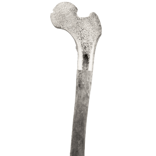 Bone Marrow Cancer