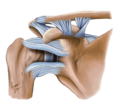 Capsular Shift Procedure