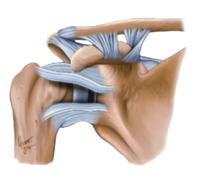 Capsular Shift Procedure