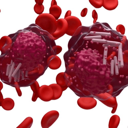 Chronic Myeloid Leukemia-CML