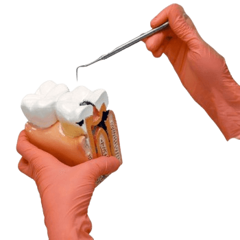 Dental Bone Grafting