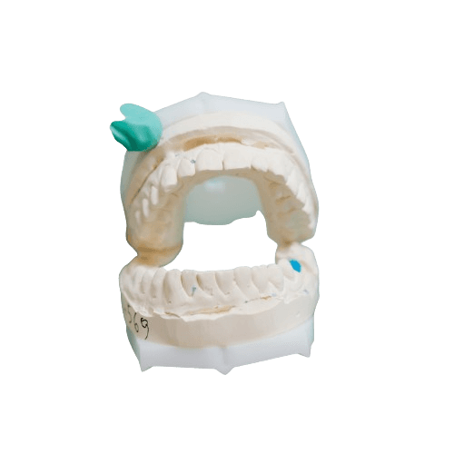Dental Sealants - Pit & Fissure Sealant