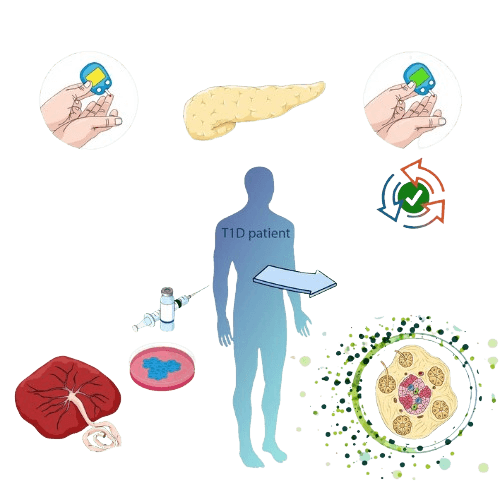 Diabetes Stem Cell Therapy