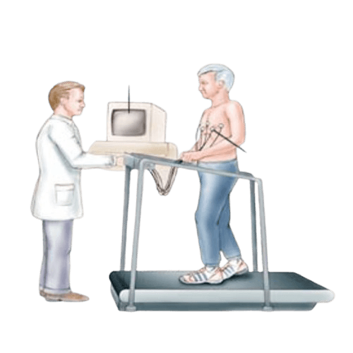 ECG - Treadmill Test (TMT)