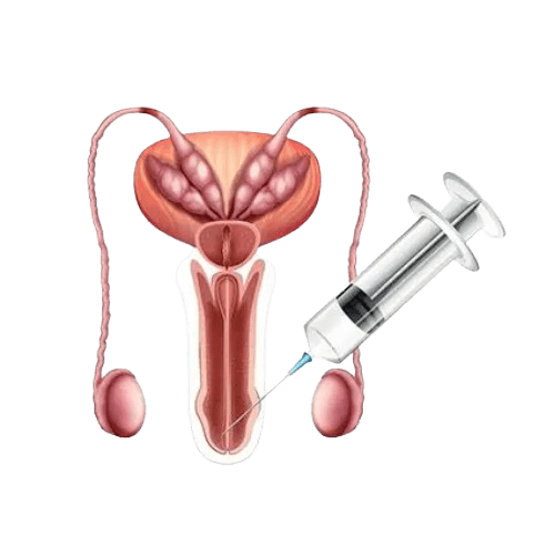 ضعف الانتصاب (Erectile Dysfunction)