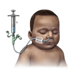 Failure to Thrive (FTT)