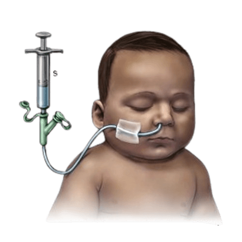 Failure to Thrive (FTT)