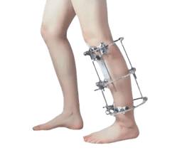 Limb Reconstruction Surgery