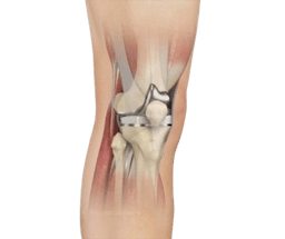 Minimally Invasive Knee Replacement Surgery