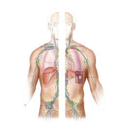 Non-Hodgkin Lymphoma (NHL)