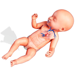 Pediatric Congestive Heart Failure