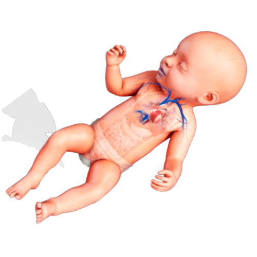 Pediatric Congestive Heart Failure