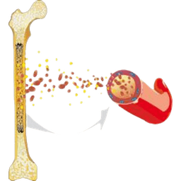 Pediatric Myelodysplastic Syndrome (MDS)