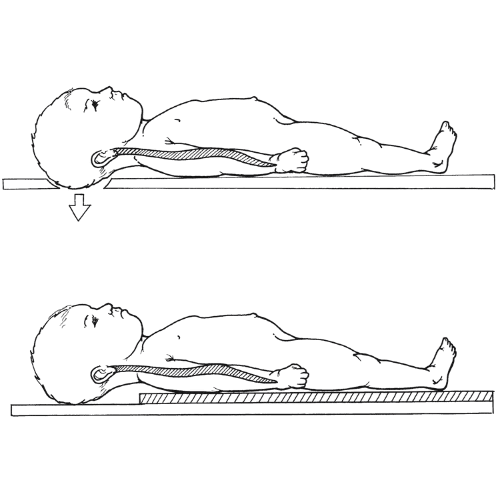 Pediatrics Head & Spine Trauma