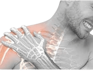 Peripheral Nerve Surgery