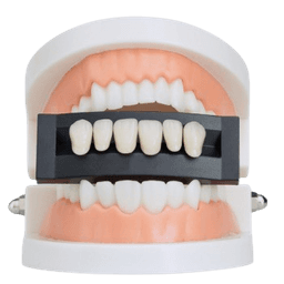 Porcelain Veneers