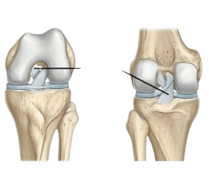 Posterior Cruciate Ligament Reconstruction-PCL