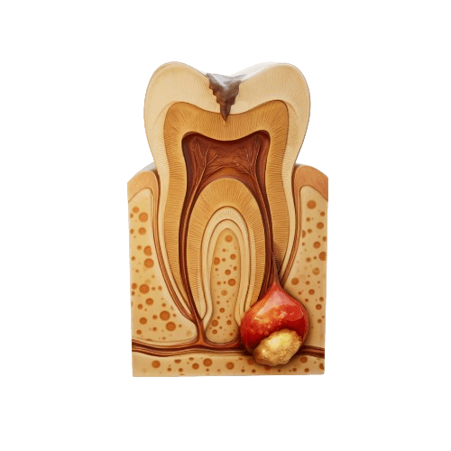 পাল্পোটমি