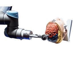 Robotic Brain Surgeries