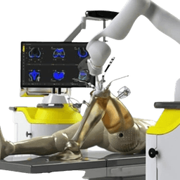 Robotic Knee Replacement Surgery