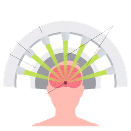 Stereotactic Radiosurgery