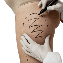 Thigh Lift Surgery