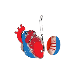 Transmyocardial Laser Revascularization (TMR)