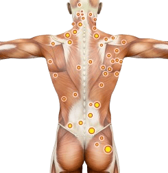 Trigger Point Injection