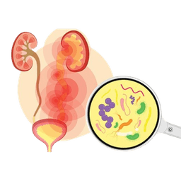 Urinary Tract Infection-UTI