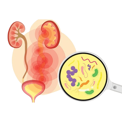 Urinary Tract Infection-UTI