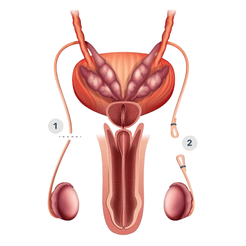 ANGIOSTOMIIA