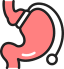 Bariatric Surgery