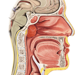 Adenotonsillectomy (Tonsil and Adenoid Removal Surgery)