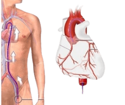 Angiography