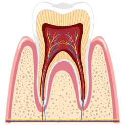 Apicoectomy