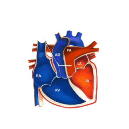 Arterial Switch Operation