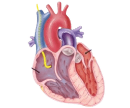 Balloon septostomy