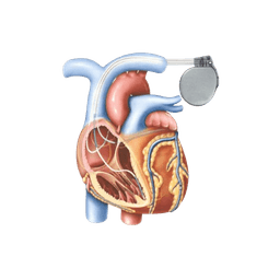 CT Angiography