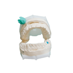 Dental Sealants - Pit & Fissure Sealant