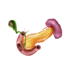 Gallbladder Cancer