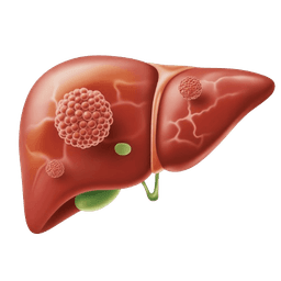 Hepatitis B