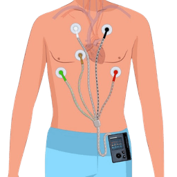 Holter Monitoring (24 hours)